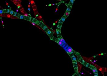 Trk and IGF1R Signaling Linked to Delayed Ewing Sarcoma Growth