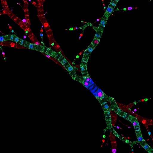 Trk and IGF1R Signaling Linked to Delayed Ewing Sarcoma Growth