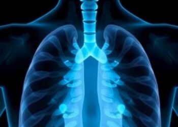 UC Study Finds Too Few Eligible Americans Discuss Lung Cancer Screening