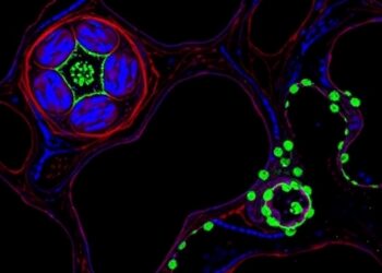 UGGT1 Drives Liver Cancer Angiogenesis by Glycosylating LGALS3BP Through NOTCH Signaling