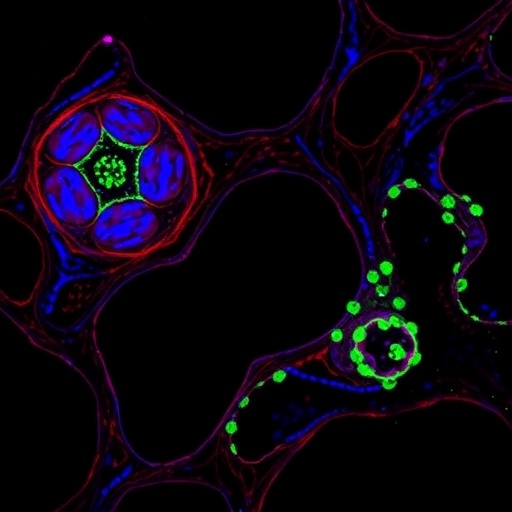 UGGT1 Drives Liver Cancer Angiogenesis by Glycosylating LGALS3BP Through NOTCH Signaling