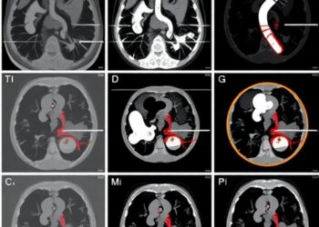 Updated imaging and intervention strategies for pediatric portal hypertension