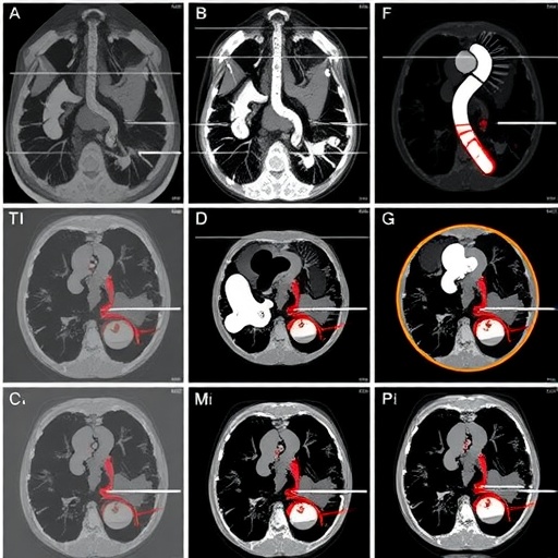 Updated imaging and intervention strategies for pediatric portal hypertension
