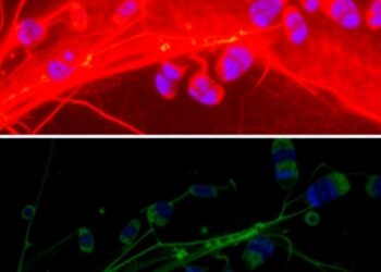 UVA-Induced Hyperploidization Causes Fibrosis in Post-Mitotic Fuchs Dystrophy Corneal Cells