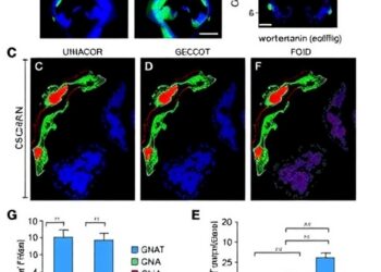 Vasopressin boosts the antiproliferative effect of dynasore and wortmannin in triple-negative breast cancer cells