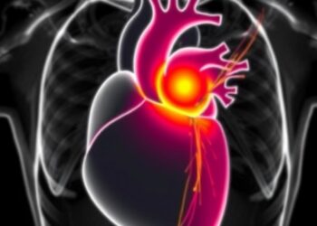 Vision-FFR trial compares vFFR with optical coherence tomography in chronic coronary syndromes