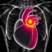 Vision-FFR trial compares vFFR with optical coherence tomography in chronic coronary syndromes