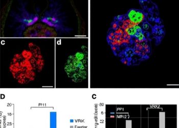 VRK2 Drives Gemcitabine Resistance in Pancreatic Cancer Through TPI1-Mediated Aerobic Glycolysis