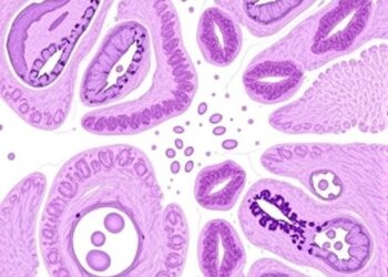 Waldenström’s macroglobulinemia in siblings: 25 years of institutional cases reviewed