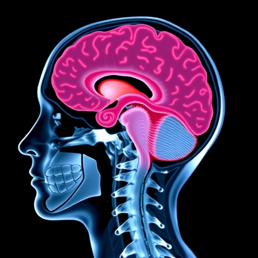 Young Survivors Face Lifelong Risk of New Aneurysms After Subarachnoid Hemorrhage