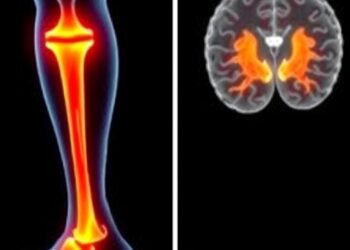 ACL Injury Alters Brain’s Movement Control, Scoping Review Finds