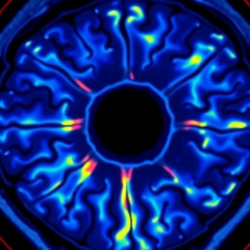 Anterior Segment OCT Imaging Predicts One-Year Success After PreserFlo MicroShunt Surgery