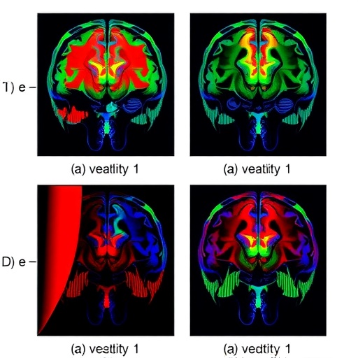 Bidirectional decoupled learning improves cross-subject emotion recognition from physiological signals