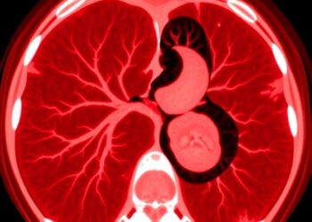 Bulbar Ulcer Reveals Rare Portal Cavernoma Diagnosis in 69-Year-Old Patient