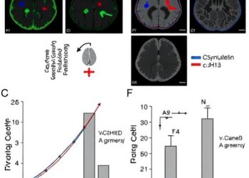 α-Synuclein curbs glioma growth via CDH13–JNK/c-Jun signaling pathway