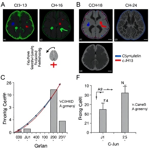 α-Synuclein curbs glioma growth via CDH13–JNK/c-Jun signaling pathway
