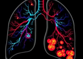 Daraxonrasib shows early antitumor activity in RAS-mutant lung cancer