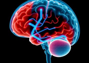 Deep brain stimulation eases severe tinnitus over two years of follow-up