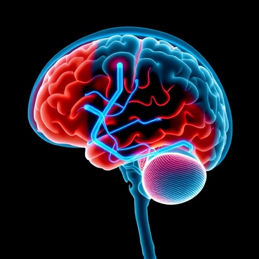 Deep brain stimulation eases severe tinnitus over two years of follow-up