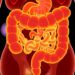 DHA eases colitis by rebalancing gut microbes and repairing the gut barrier