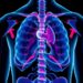 Diabetes Lowers Survival Across Many Cancer Types, Study Finds