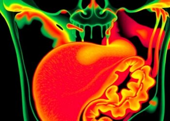 Diffusion model boosts tongue image augmentation for colorectal cancer detection
