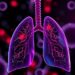 Dimethyl phthalate triggers oxidative stress and inflammation in lung cells