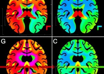 Distinct hypothalamic regions implicated in late-onset Alzheimer’s disease and normal aging