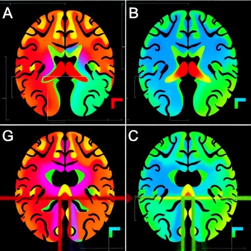 Distinct hypothalamic regions implicated in late-onset Alzheimer’s disease and normal aging