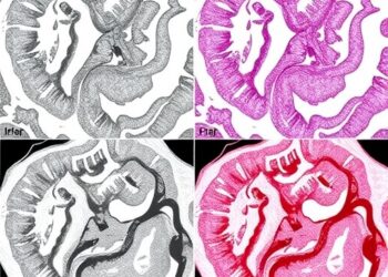 Enhanced INFO algorithm enables multi-threshold segmentation of colorectal cancer histopathology images