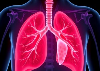 Expert consensus outlines evidence-based management of pediatric pulmonary embolism
