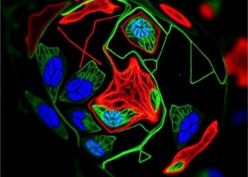 FAM120A acts as a new effector in progranulin/EphA2-driven bladder cancer
