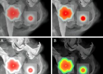 Fuzzy attention-based encoder-decoder improves skin lesion segmentation accuracy