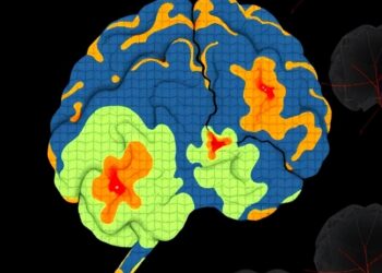 Geospatial study links cardiometabolic diseases to Lewy body dementia risk in Medicare beneficiaries
