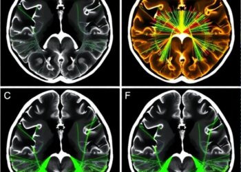 Graph-Based White Matter Tractometry: Methods, Applications, and Validation Paths