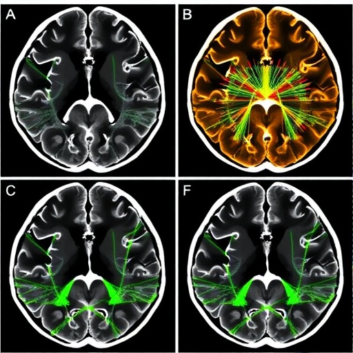 Graph-Based White Matter Tractometry: Methods, Applications, and Validation Paths