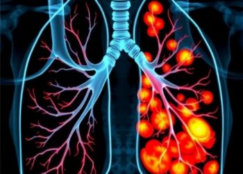 High-resolution radiomics model predicts invasiveness of pure ground-glass lung adenocarcinoma