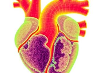 Human Mitral Valve Cells Show Distinct 3D Remodeling in Prolapse