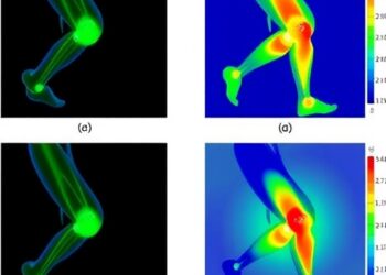 Hybrid diffusion-routing models capture long-range knee contact mechanics
