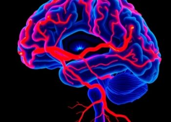 Inflammation of brain blood vessels drives cortical superficial siderosis in cerebral amyloid angiopathy