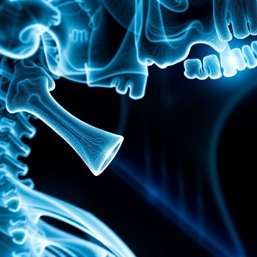 Jaw bone death risk in osteoporosis patients on antiresorptive drugs