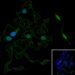 Keratin 17 promotes endometrial cancer aggressiveness through epithelial-mesenchymal transition