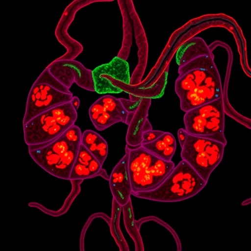 KRAS mutation subtypes reshape tumor microenvironment and survival in colorectal cancer