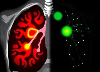 Latent diffusion models generate lung nodule CT images from LIDC-IDRI