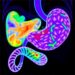 Lynch Syndrome Linked to Metastatic Nonfunctional Pancreatic Neuroendocrine Tumor