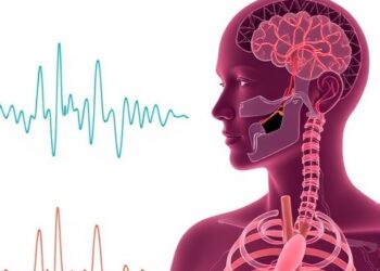 Machine Learning Detects Anaphylaxis Early from Real-World Physiological Data