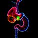 Machine learning predicts survival and chemotherapy benefit in gastric cancer