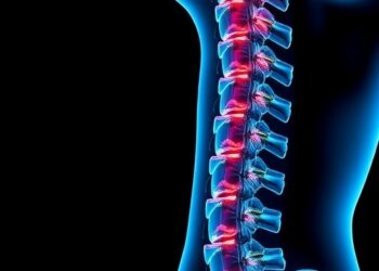 Many microbial molecules worsen abnormal bone growth after spinal cord injury