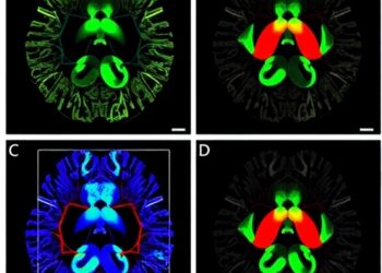 Measuring Correlogram Shape Reveals Neuronal Firing Patterns in TBI-on-a-Chip