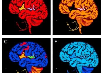 Mechanistic modeling reveals glioblastoma evolution with clinical implications